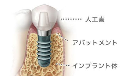 立川アローズ歯科クリニックのカウンセリング